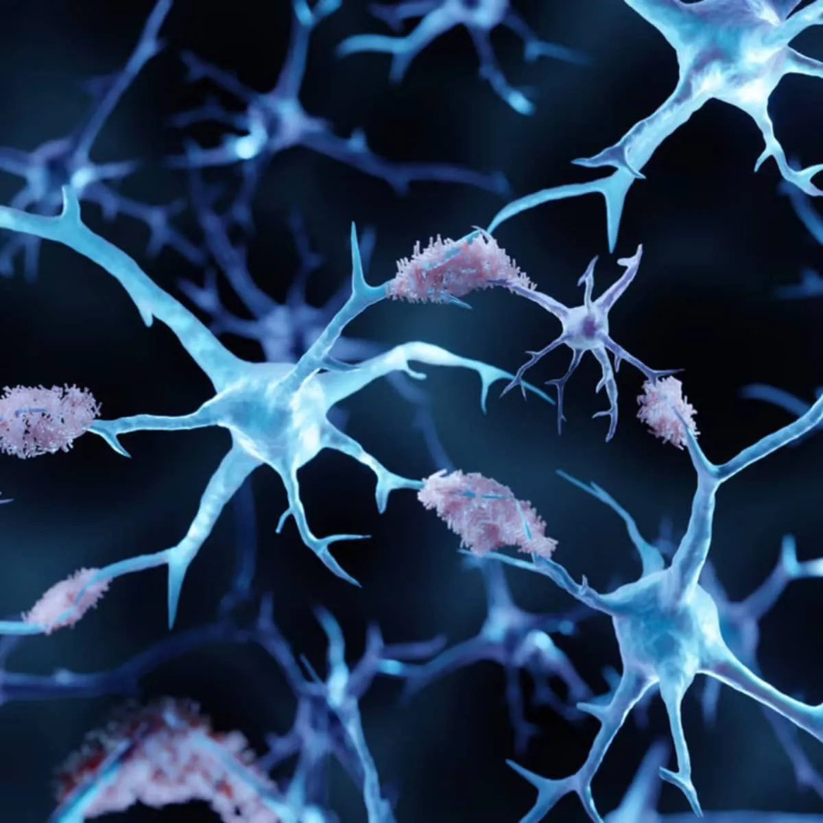 Diepe slaap kan je tegen Alzheimer beschermen